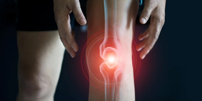 Arthrose Gelenkschmerzen Ursachen Behandlung Chondroitin